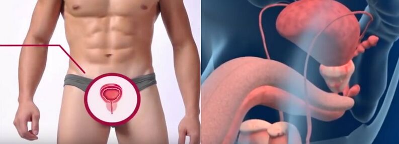 Prostatitis in men, recognized by a number of signs